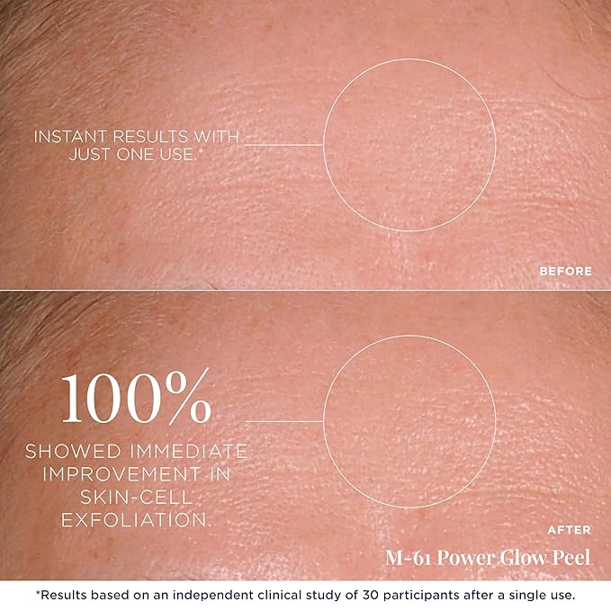 m-61 PowerGlow Peel | Exfoliating Facial Peel With Glycolic, Salicylic Acid. 1 Minute, 1 Step - 60 Treatments-GravixFit
