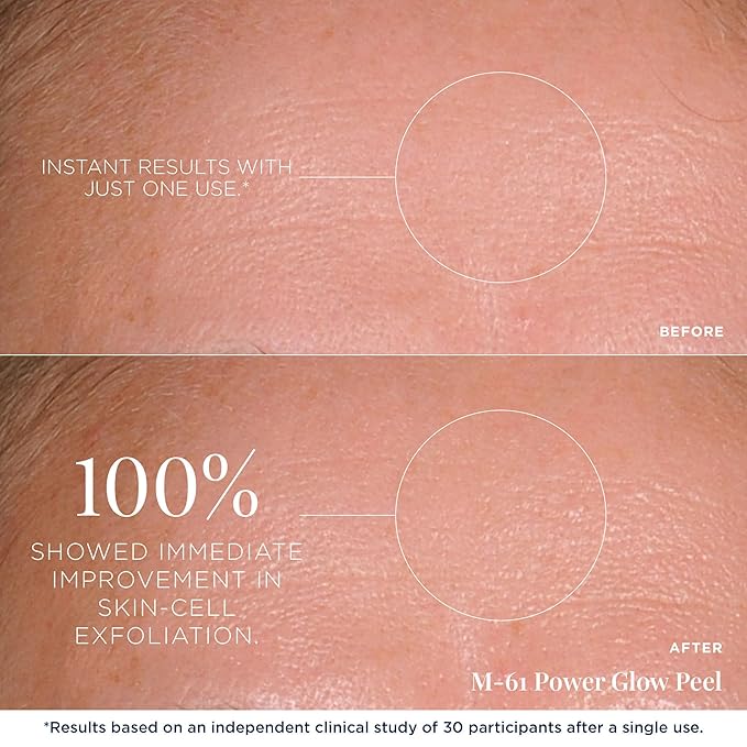 m-61 PowerGlow Peel | Exfoliating Facial Peel With Glycolic, Salicylic Acid. 1 Minute, 1 Step - 30 Treatments-GravixFit